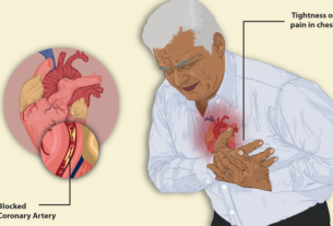 What are the differences between "cardiac arrest" and "heart attack"?