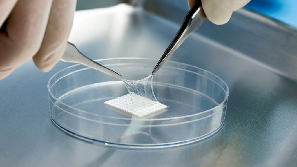 Amniotic Products Market Overview 2025 | Regional Overview, Analysis, and Future Outlook