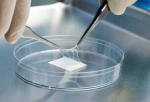 Amniotic Products Market Overview 2025 | Regional Overview, Analysis, and Future Outlook