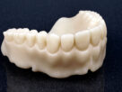 Dental 3D Printing