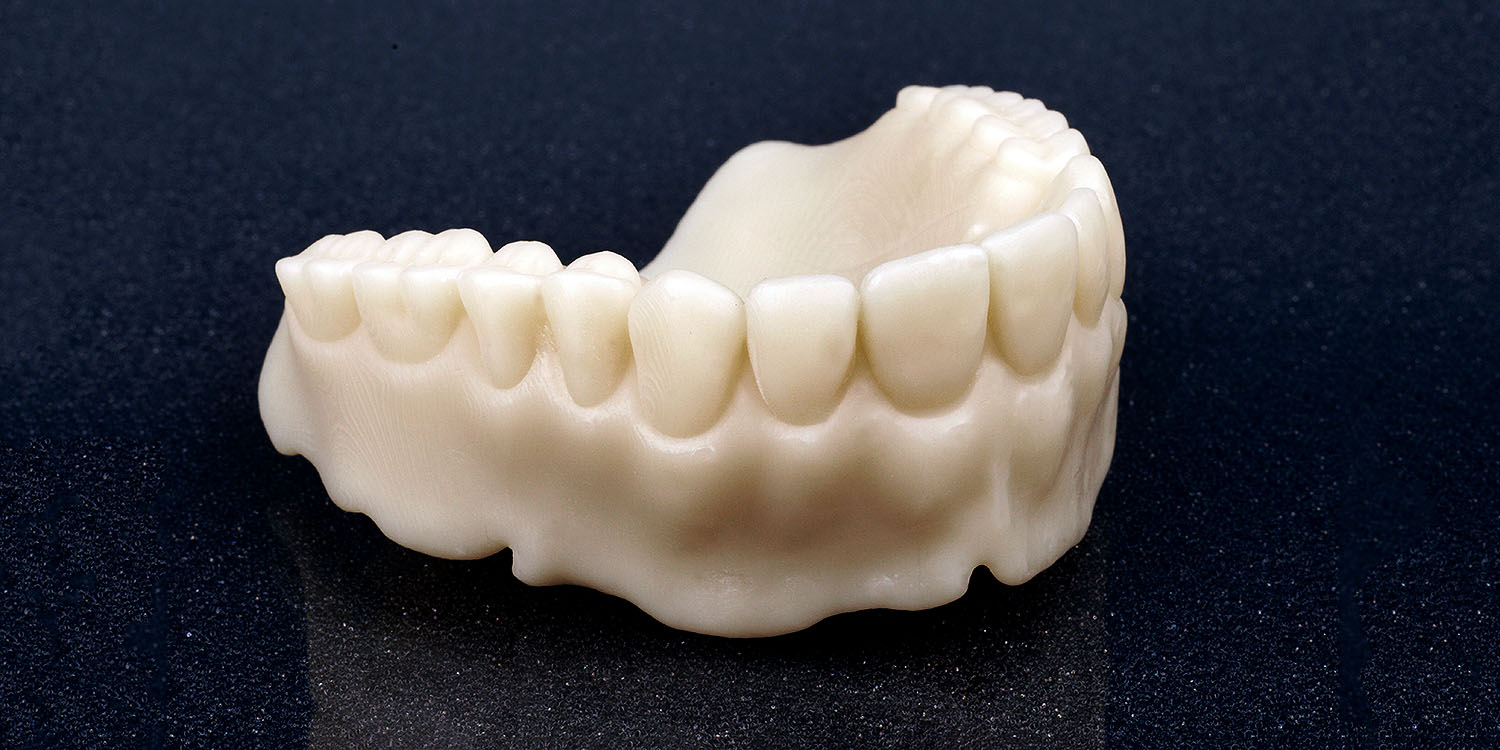 Dental 3D Printing