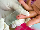 Malaria Diagnostics