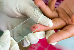 Malaria Diagnostics
